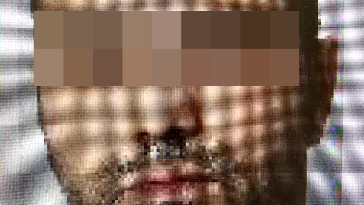 جريمة مروعة في ألمانيا: إيراني يقتل امرأة برباط كلبها بعد فشل ترحيله المتكرر