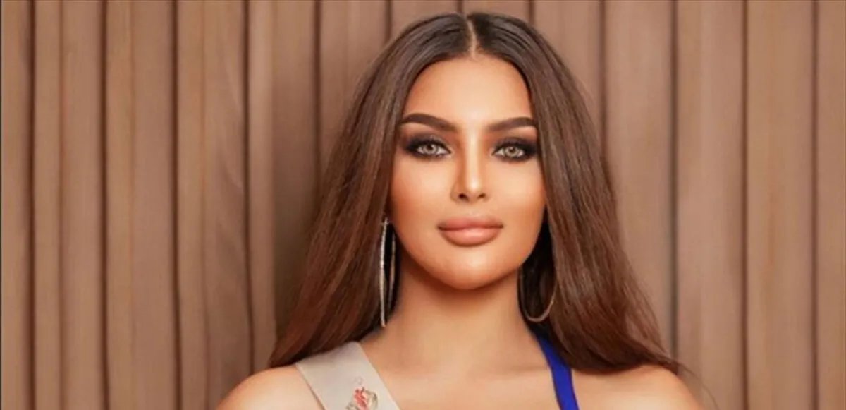 رومي القحطاني ملكة جمال السعودية تكشف عن تشوه في وجهها وتصرح: "استحملت اللي صار"