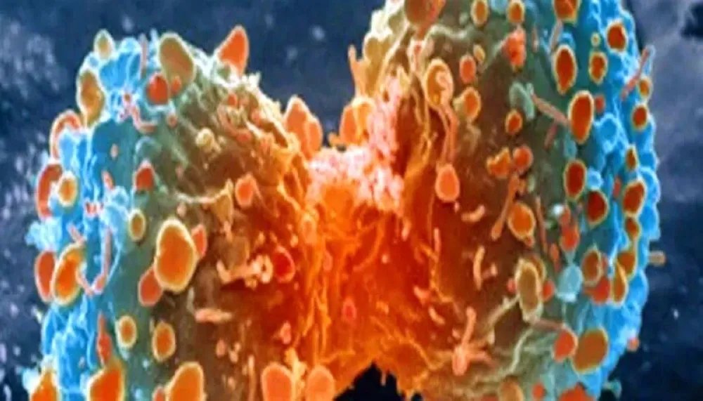 اكتشاف واعد: آلية جديدة لعلاج سرطان البنكرياس بتحفيز المناعة