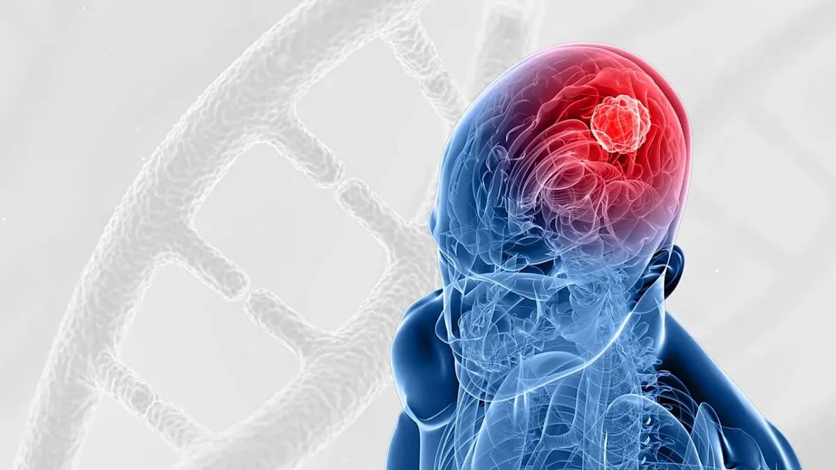 اختراق طبي: علاج خلوي جديد يبشر بالأمل في مكافحة أخطر أورام الدماغ