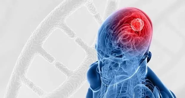 اختراق طبي: علاج خلوي جديد يبشر بالقضاء على أخطر أورام الدماغ