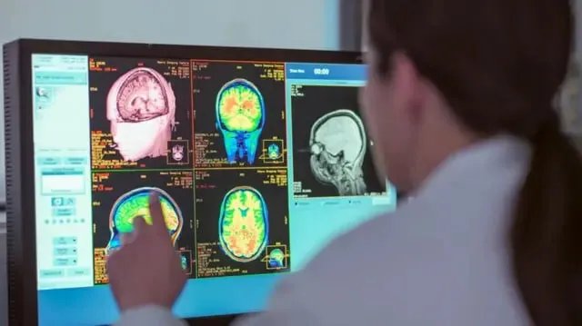 دراسة تكشف: كيف تتغير طريقة عمل الدماغ مع التقدم في العمر وتؤثر على السلوك والإدراك؟