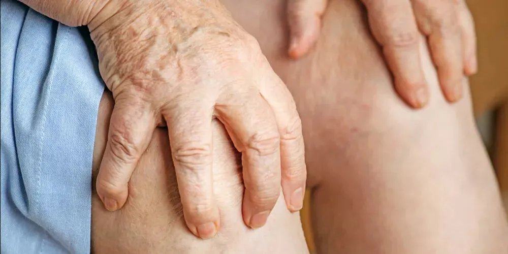 اختراق طبي: دواء جديد بالأجسام المضادة يقلل نوبات النقرس الحادة بنسبة كبيرة