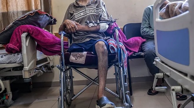 كارثة إنسانية في غزة: 6000 بترت أطرافهم يحتاجون تأهيلاً عاجلاً