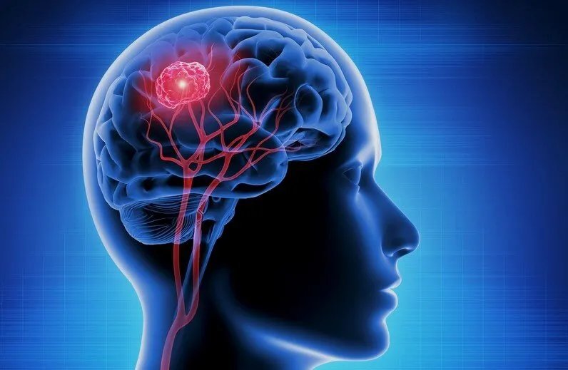 طفرة طبية: قطرات أنف تقوي المناعة لمكافحة أورام المخ الخطيرة