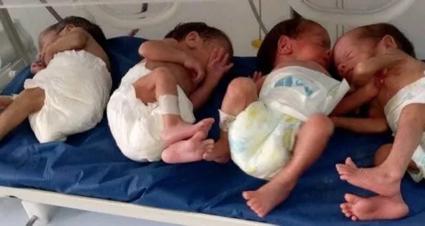 بانياس: ولادة مفاجئة لأربعة توائم تبهج مستشفى بانياس الوطني